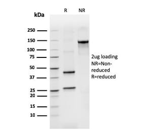 SDS-PAGE - Anti-Bcl2L2 Antibody [CPTC-BCL2L2-2] - BSA and Azide free (A253073) - Antibodies.com