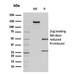 SDS-PAGE - Anti-alpha Smooth Muscle Actin Antibody [SPM332] - BSA and Azide free (A253075) - Antibodies.com