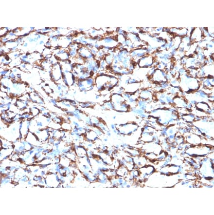 Immunohistochemistry - Anti-alpha Smooth Muscle Actin Antibody [ACTA2/791] - BSA and Azide free (A253076) - Antibodies.com
