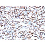 Immunohistochemistry - Anti-alpha Smooth Muscle Actin Antibody [ACTA2/791] - BSA and Azide free (A253076) - Antibodies.com