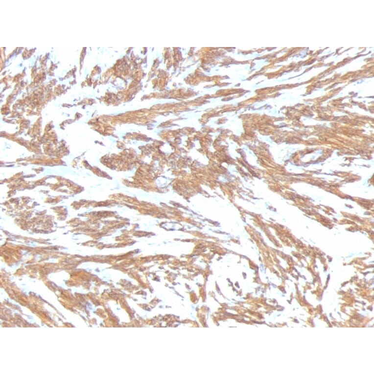 Immunohistochemistry - Anti-alpha Smooth Muscle Actin Antibody [ACTA2/791] - BSA and Azide free (A253076) - Antibodies.com