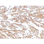 Immunohistochemistry - Anti-alpha Smooth Muscle Actin Antibody [ACTA2/791] - BSA and Azide free (A253076) - Antibodies.com