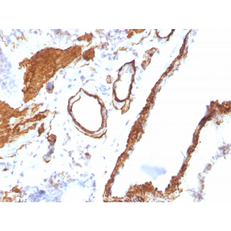 Immunohistochemistry - Anti-alpha Smooth Muscle Actin Antibody [ACTA2/791] - BSA and Azide free (A253076) - Antibodies.com