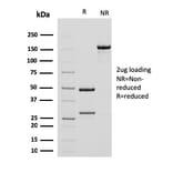 SDS-PAGE - Anti-alpha Smooth Muscle Actin Antibody [ACTA2/791] - BSA and Azide free (A253076) - Antibodies.com