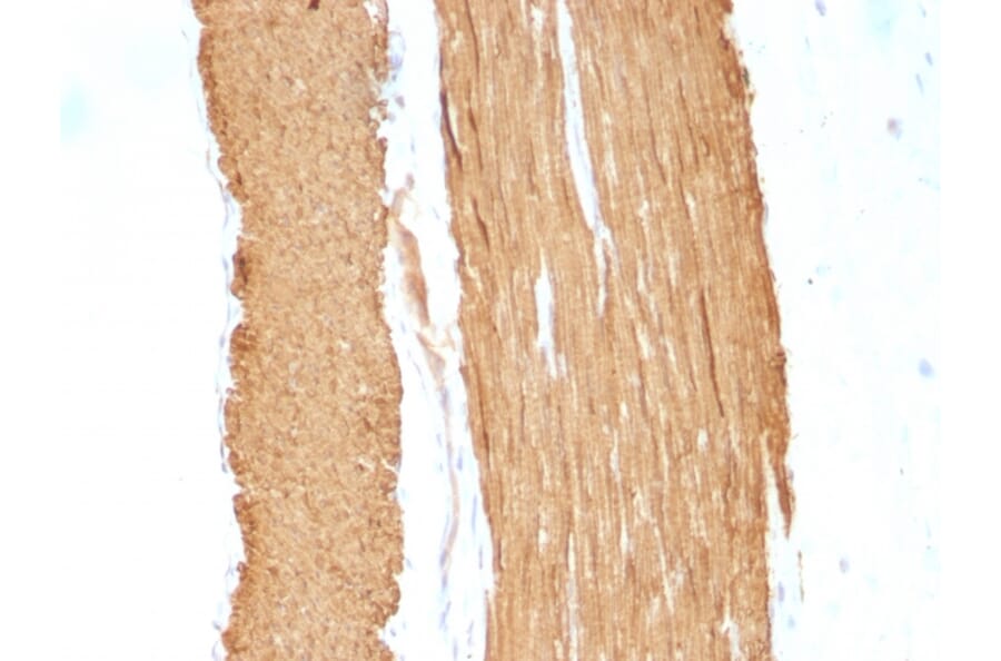 Immunohistochemistry - Anti-alpha Smooth Muscle Actin Antibody [1A4 + ACTA2/791] - BSA and Azide free (A253077) - Antibodies.com