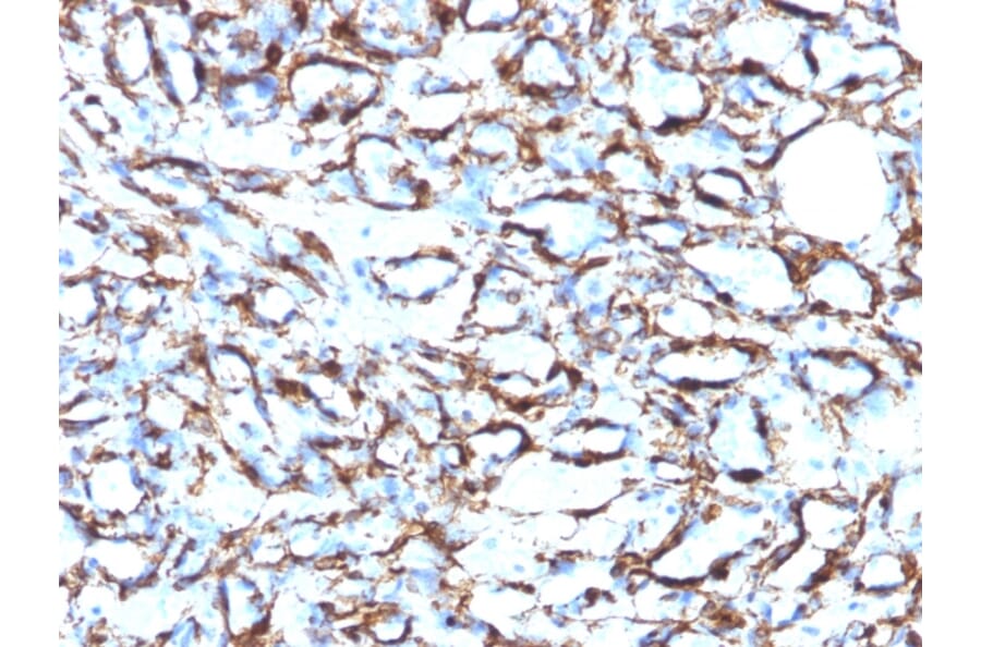 Immunohistochemistry - Anti-alpha Smooth Muscle Actin Antibody [1A4 + ACTA2/791] - BSA and Azide free (A253077) - Antibodies.com