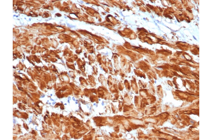 Immunohistochemistry - Anti-alpha Smooth Muscle Actin Antibody [rACTA2/1625] - BSA and Azide free (A253078) - Antibodies.com