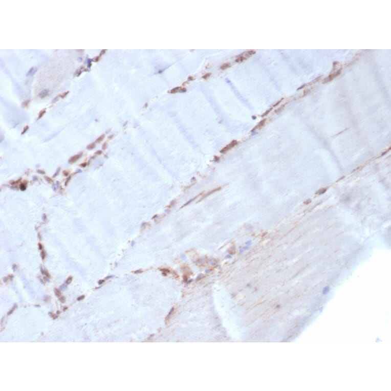 Immunohistochemistry - Anti-alpha Smooth Muscle Actin Antibody [rACTA2/1625] - BSA and Azide free (A253077) - Antibodies.com