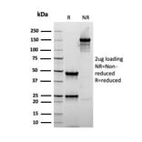 SDS-PAGE - Anti-alpha Smooth Muscle Actin Antibody [rACTA2/1625] - BSA and Azide free (A253078) - Antibodies.com
