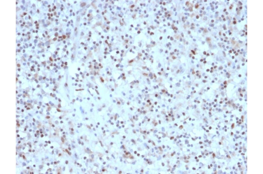 Immunohistochemistry - Anti-Bcl-6 Antibody [rBCL6/1527] - BSA and Azide free (A253079) - Antibodies.com