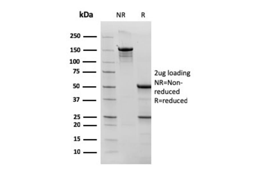 SDS-PAGE - Anti-Bcl-6 Antibody [rBCL6/1527] - BSA and Azide free (A253079) - Antibodies.com
