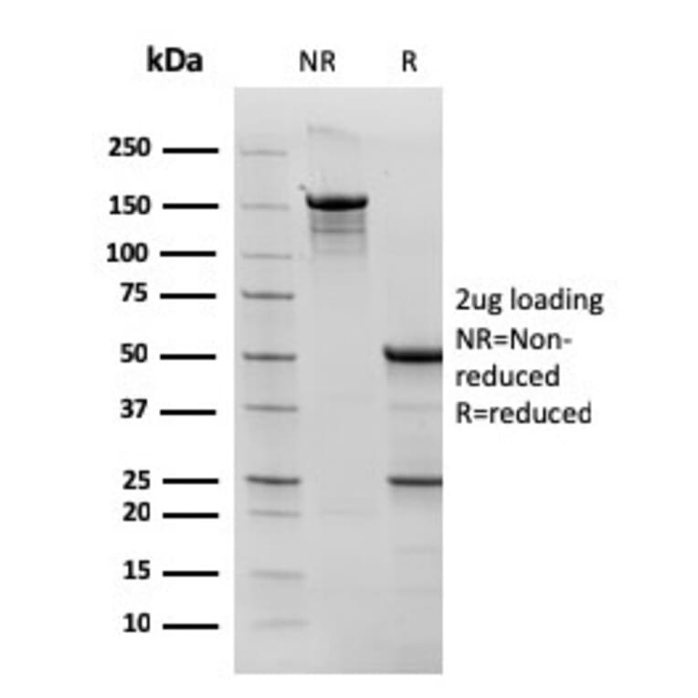 SDS-PAGE - Anti-Bcl-6 Antibody [rBCL6/1527] - BSA and Azide free (A253079) - Antibodies.com
