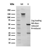 SDS-PAGE - Anti-Bcl-6 Antibody [rBCL6/1527] - BSA and Azide free (A253079) - Antibodies.com