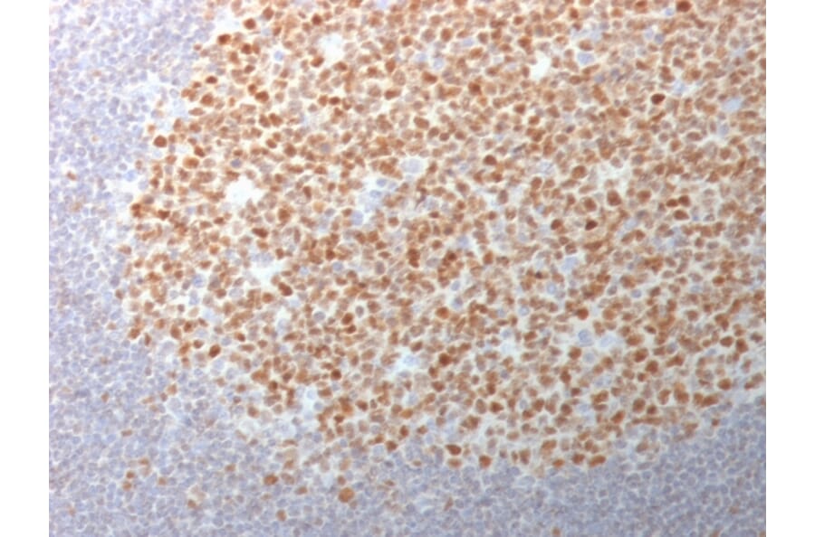 Immunohistochemistry - Anti-Bcl-6 Antibody [BCL6/1982] - BSA and Azide free (A253080) - Antibodies.com