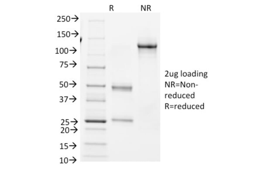 SDS-PAGE - Anti-Bcl-6 Antibody [BCL6/1982] - BSA and Azide free (A253080) - Antibodies.com