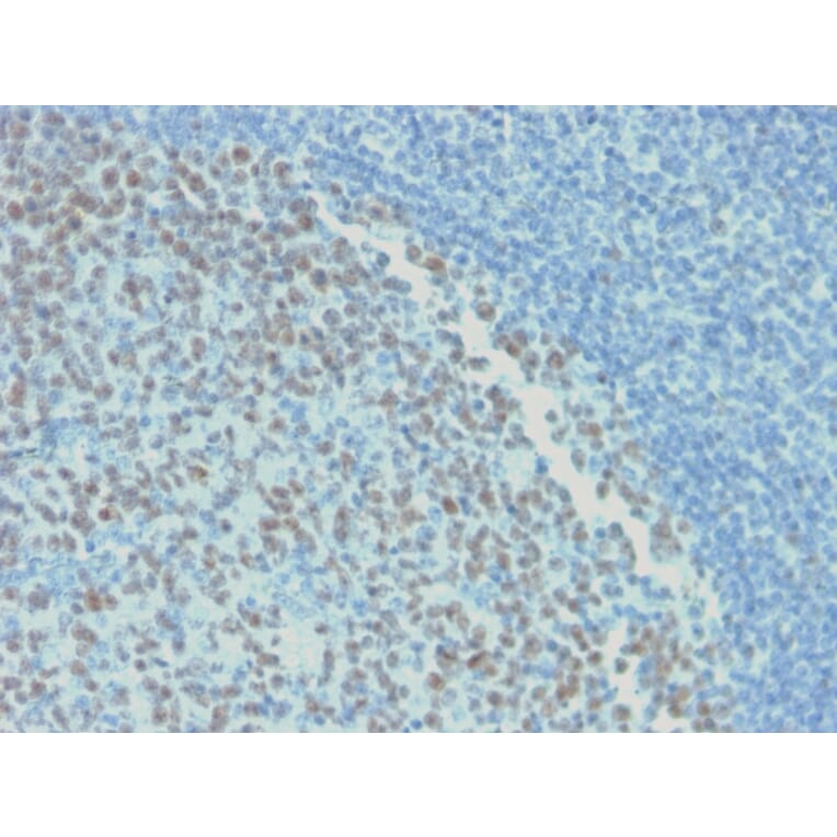 Immunohistochemistry - Anti-Bcl-6 Antibody [rBCL6/1718] - BSA and Azide free (A253080) - Antibodies.com