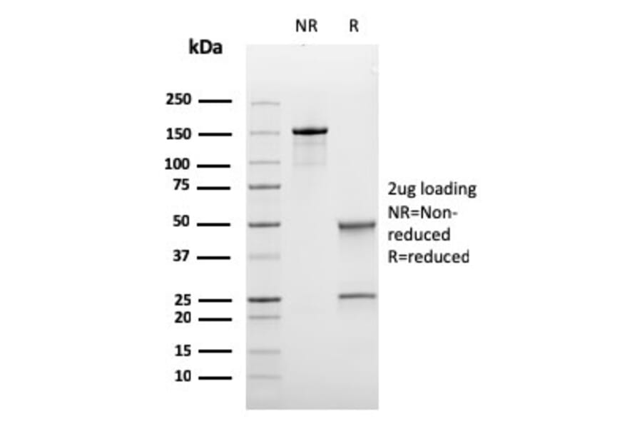 SDS-PAGE - Anti-Bcl-6 Antibody [rBCL6/1718] - BSA and Azide free (A253081) - Antibodies.com