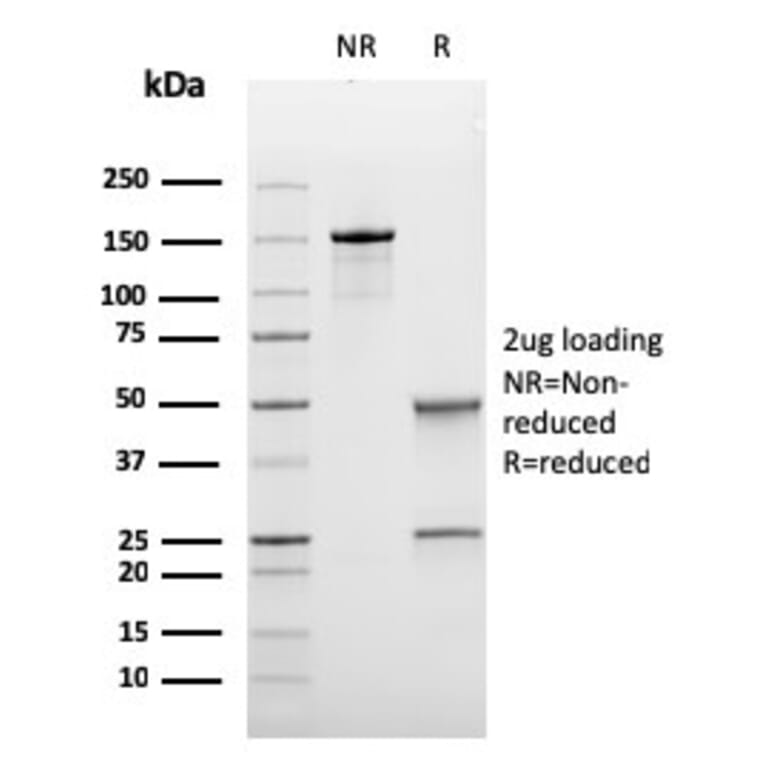 SDS-PAGE - Anti-Bcl-6 Antibody [rBCL6/1718] - BSA and Azide free (A253081) - Antibodies.com