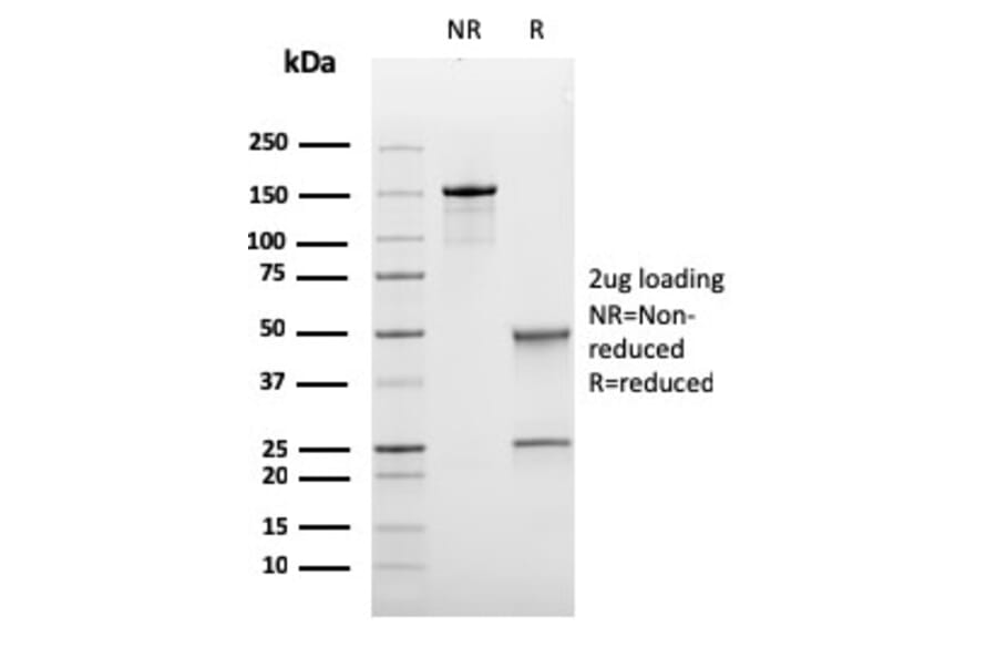 SDS-PAGE - Anti-Bcl-6 Antibody [rBCL6/1475] - BSA and Azide free (A253081) - Antibodies.com