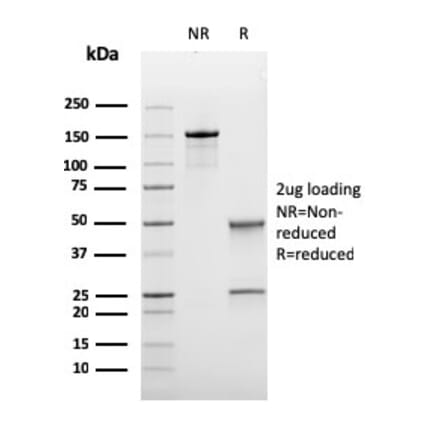 SDS-PAGE - Anti-Bcl-6 Antibody [rBCL6/1475] - BSA and Azide free (A253081) - Antibodies.com