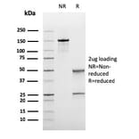 SDS-PAGE - Anti-Bcl-6 Antibody [rBCL6/1475] - BSA and Azide free (A253081) - Antibodies.com