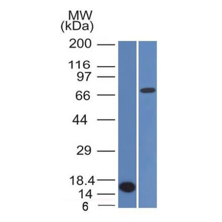 Western Blot - Anti-Bcl-6 Antibody [BCL6/1475] - BSA and Azide free (A253084) - Antibodies.com