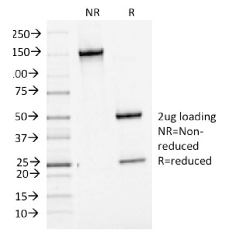 SDS-PAGE - Anti-Bcl-6 Antibody [BCL6/1475] - BSA and Azide free (A253084) - Antibodies.com