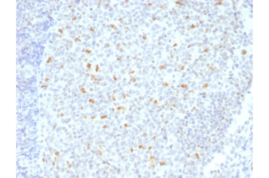 Immunohistochemistry - Anti-Bcl-6 Antibody [BCL6/1526] - BSA and Azide free (A253085) - Antibodies.com