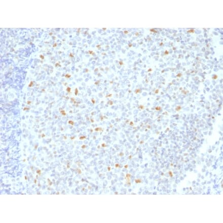 Immunohistochemistry - Anti-Bcl-6 Antibody [BCL6/1526] - BSA and Azide free (A253085) - Antibodies.com