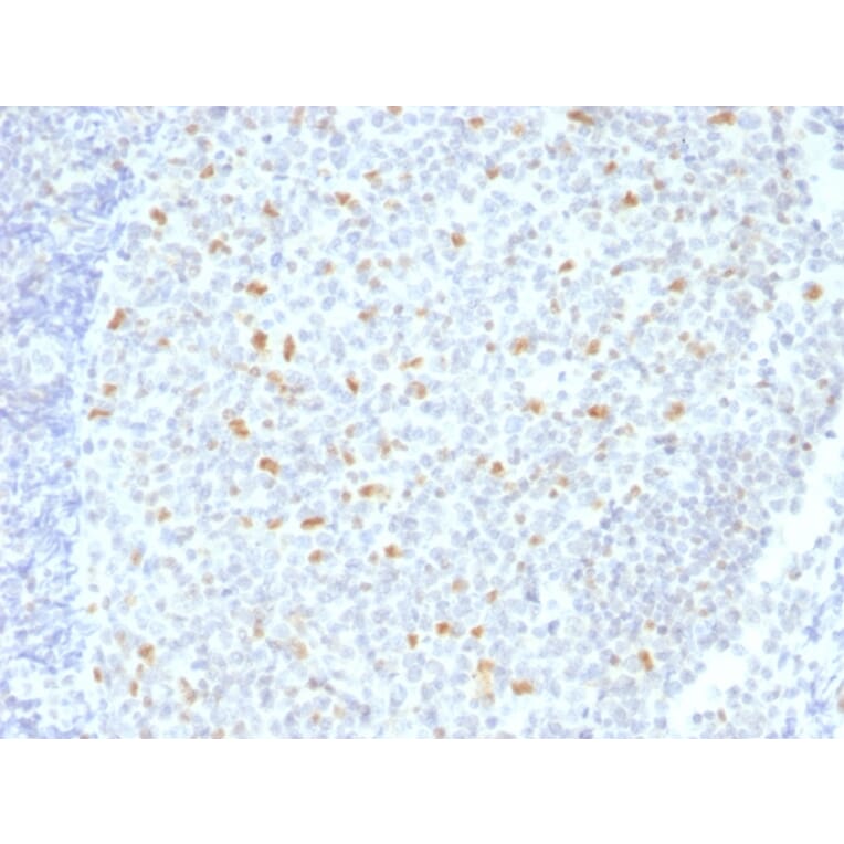 Immunohistochemistry - Anti-Bcl-6 Antibody [BCL6/1526] - BSA and Azide free (A253085) - Antibodies.com