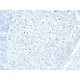 Immunohistochemistry - Anti-Bcl-6 Antibody [BCL6/1526] - BSA and Azide free (A253085) - Antibodies.com