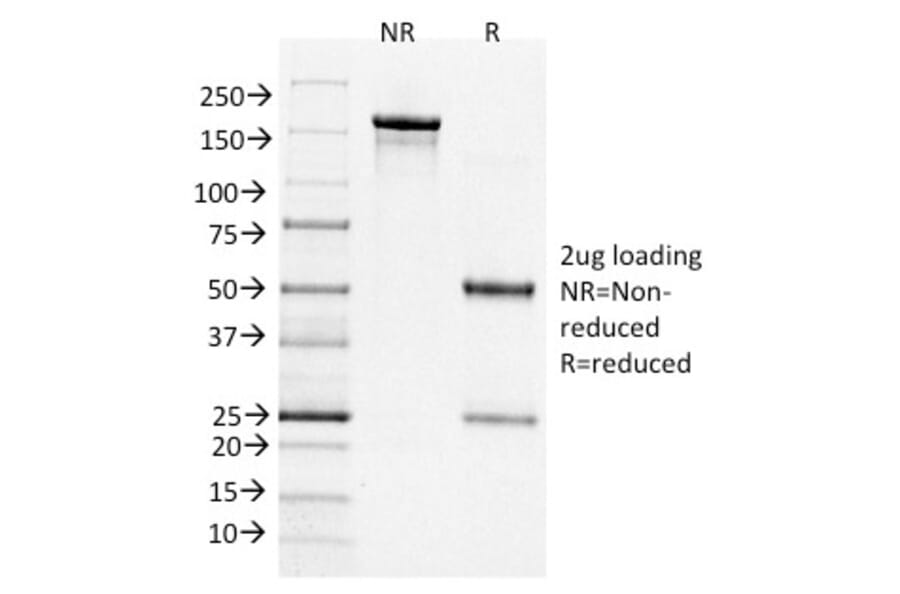 SDS-PAGE - Anti-Bcl-6 Antibody [BCL6/1526] - BSA and Azide free (A253085) - Antibodies.com