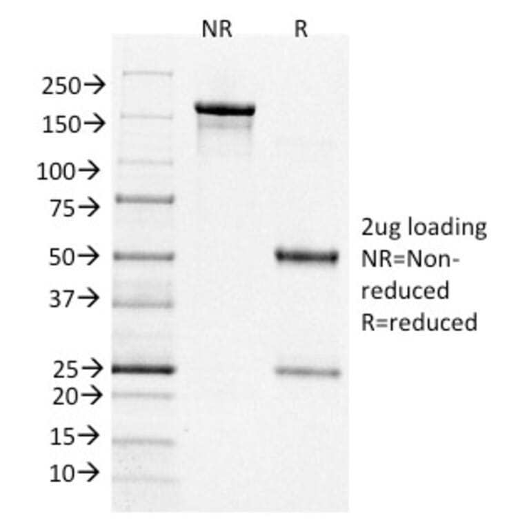 SDS-PAGE - Anti-Bcl-6 Antibody [BCL6/1526] - BSA and Azide free (A253085) - Antibodies.com