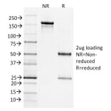 SDS-PAGE - Anti-Bcl-6 Antibody [BCL6/1526] - BSA and Azide free (A253085) - Antibodies.com