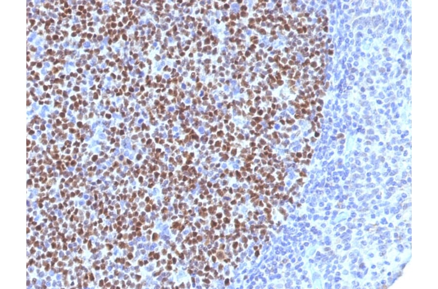 Immunohistochemistry - Anti-Bcl-6 Antibody [BCL6/1527] - BSA and Azide free (A253086) - Antibodies.com