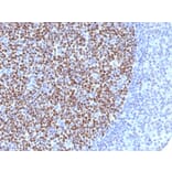 Immunohistochemistry - Anti-Bcl-6 Antibody [BCL6/1527] - BSA and Azide free (A253086) - Antibodies.com
