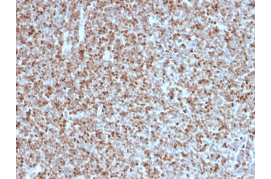 Immunohistochemistry - Anti-Bcl-6 Antibody [BCL6/1527] - BSA and Azide free (A253086) - Antibodies.com
