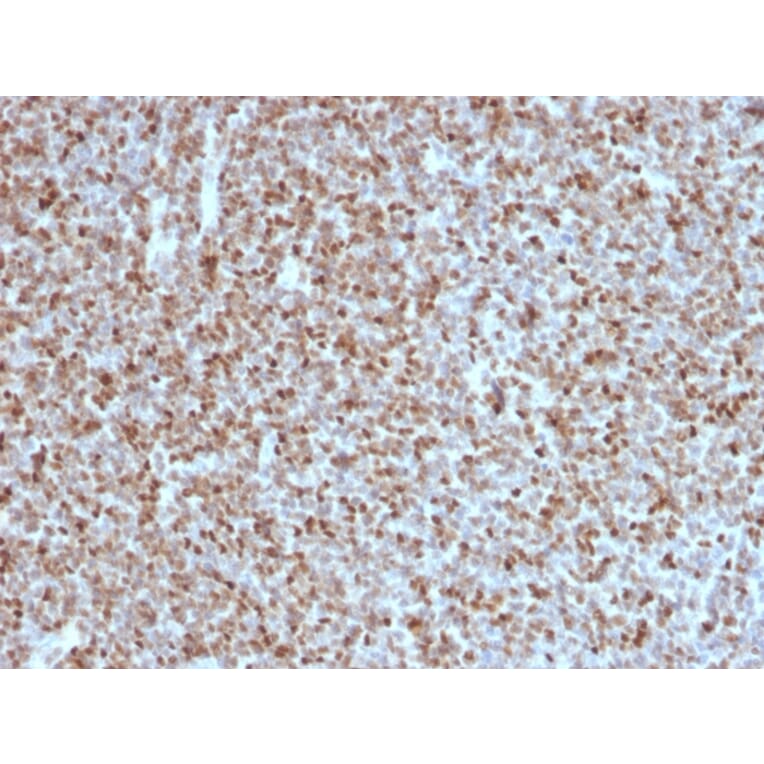 Immunohistochemistry - Anti-Bcl-6 Antibody [BCL6/1527] - BSA and Azide free (A253086) - Antibodies.com