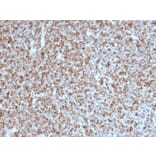 Immunohistochemistry - Anti-Bcl-6 Antibody [BCL6/1527] - BSA and Azide free (A253086) - Antibodies.com