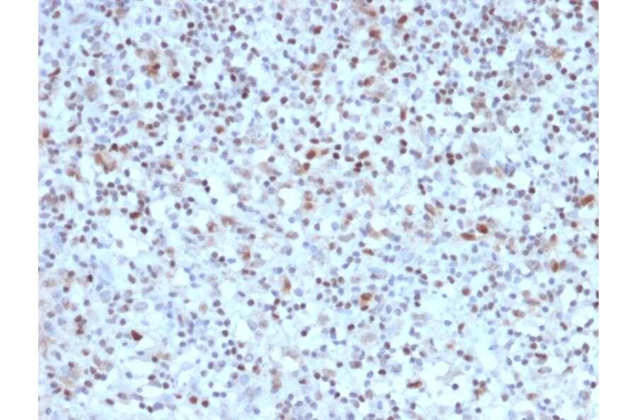 Immunohistochemistry - Anti-Bcl-6 Antibody [BCL6/1527] - BSA and Azide free (A253086) - Antibodies.com