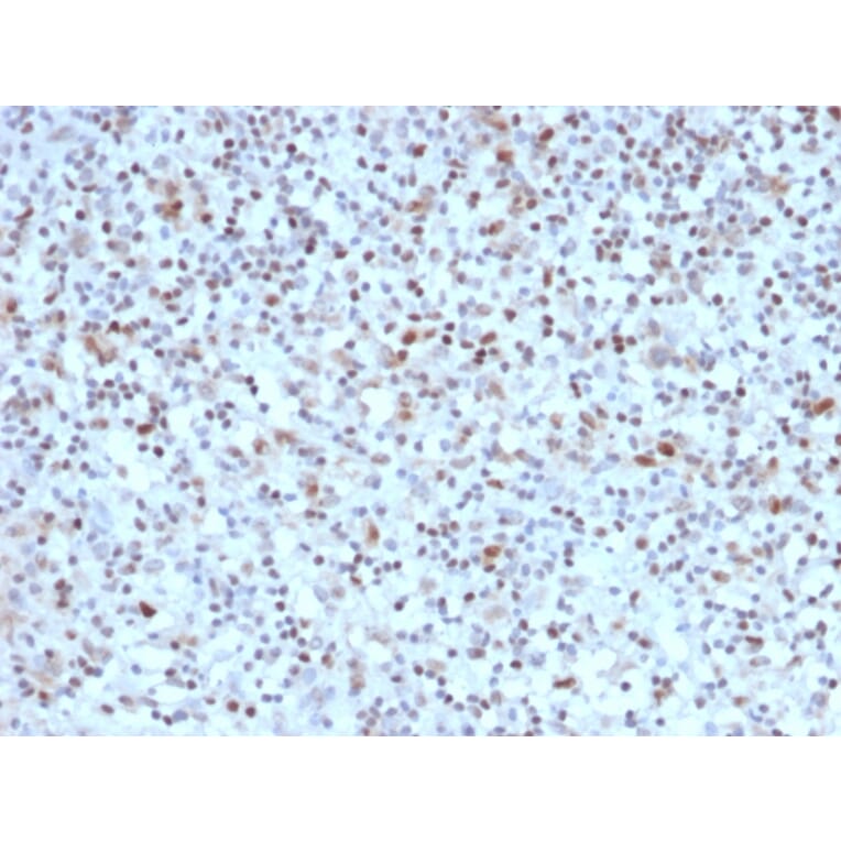 Immunohistochemistry - Anti-Bcl-6 Antibody [BCL6/1527] - BSA and Azide free (A253086) - Antibodies.com