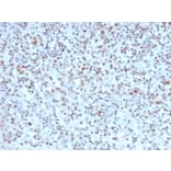 Immunohistochemistry - Anti-Bcl-6 Antibody [BCL6/1527] - BSA and Azide free (A253086) - Antibodies.com