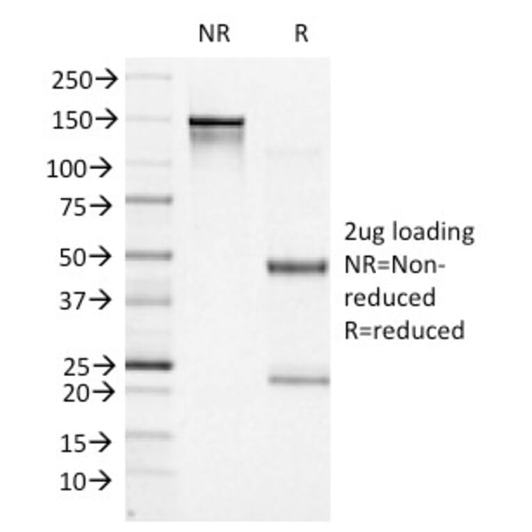 SDS-PAGE - Anti-Bcl-6 Antibody [BCL6/1527] - BSA and Azide free (A253086) - Antibodies.com