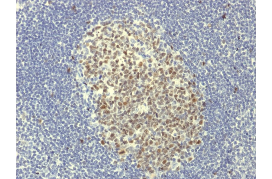 Immunohistochemistry - Anti-Bcl-6 Antibody [BCL6/1951R] - BSA and Azide free (A253088) - Antibodies.com