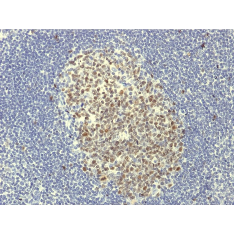 Immunohistochemistry - Anti-Bcl-6 Antibody [BCL6/1951R] - BSA and Azide free (A253088) - Antibodies.com