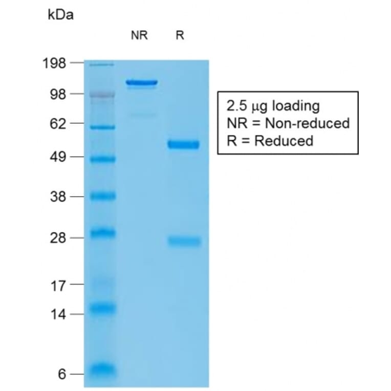 SDS-PAGE - Anti-Bcl-6 Antibody [BCL6/1951R] - BSA and Azide free (A253088) - Antibodies.com