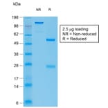 SDS-PAGE - Anti-Bcl-6 Antibody [BCL6/1951R] - BSA and Azide free (A253088) - Antibodies.com