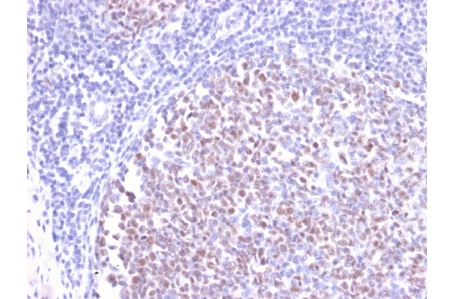 Immunohistochemistry - Anti-Bcl-6 Antibody [BCL6/2497R] - BSA and Azide free (A253088) - Antibodies.com