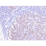 Immunohistochemistry - Anti-Bcl-6 Antibody [BCL6/2497R] - BSA and Azide free (A253088) - Antibodies.com