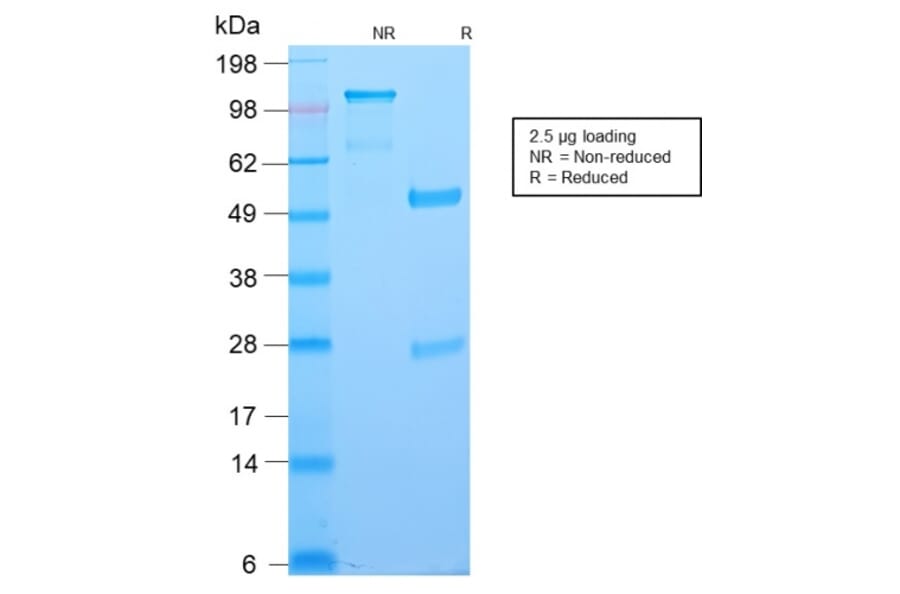 SDS-PAGE - Anti-Bcl-6 Antibody [BCL6/2497R] - BSA and Azide free (A253089) - Antibodies.com